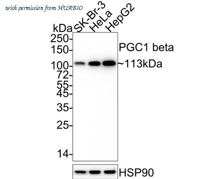 HUABIO ET1705-65 image 1