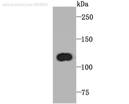 HUABIO ET1705-65 image 2