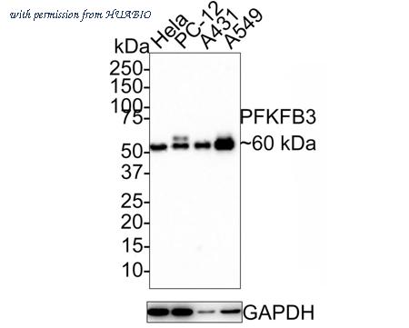 HUABIO ET1705-66 image 2