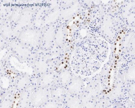 HUABIO ET1705-66 image 3