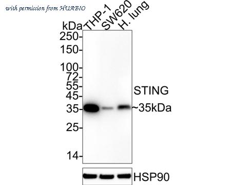 HUABIO ET1705-68 image 1