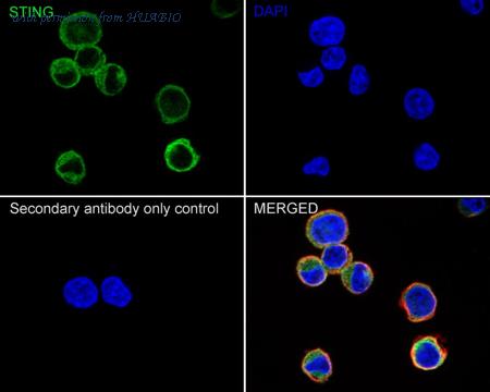 HUABIO ET1705-68 image 2
