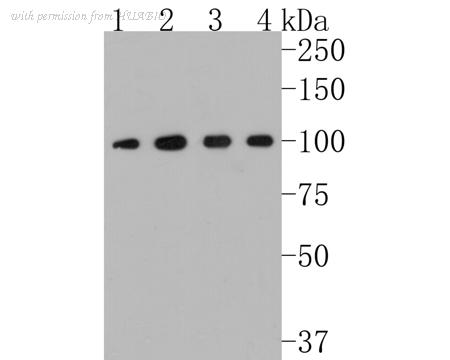 HUABIO ET1705-69 image 1