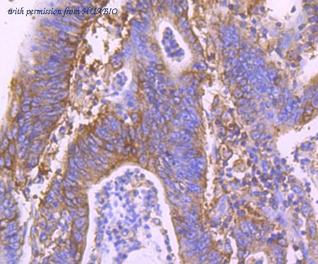 HUABIO ET1705-69 image 2