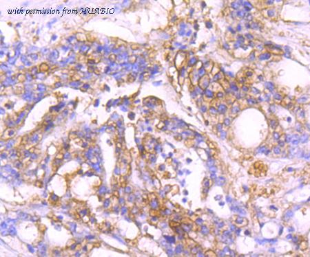 HUABIO ET1705-69 image 3