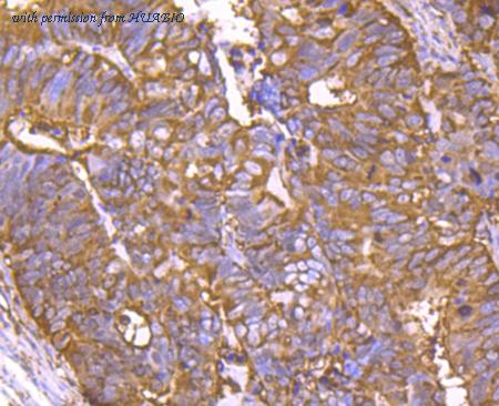 HUABIO ET1705-7 image 2