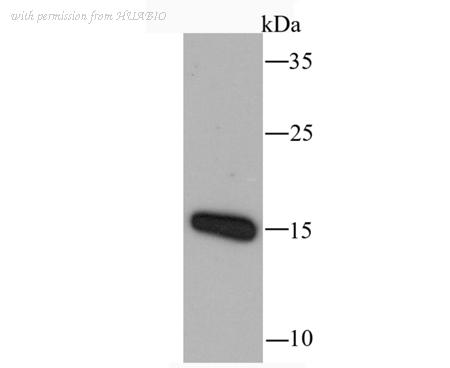 HUABIO ET1705-70 image 1