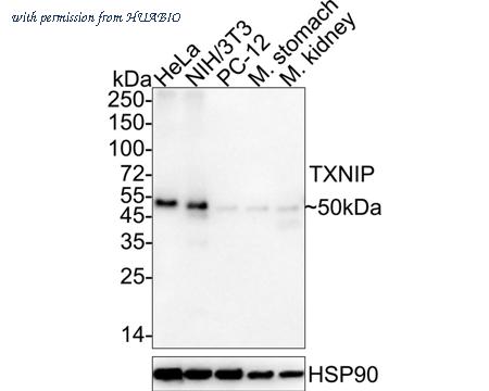 HUABIO ET1705-72-50UL image 1