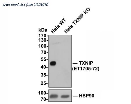HUABIO ET1705-72-50UL image 2
