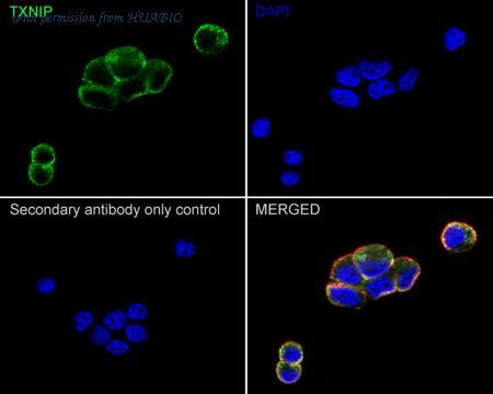 HUABIO ET1705-72-50UL image 3