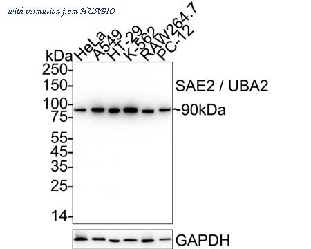 HUABIO ET1705-73 image 1