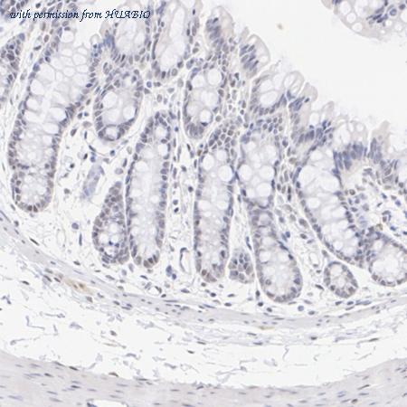 HUABIO ET1705-73 image 3