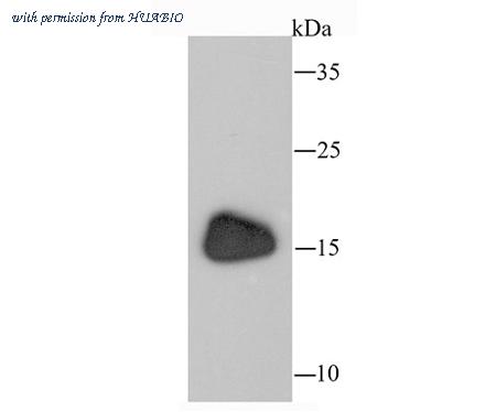 HUABIO ET1705-75 image 1