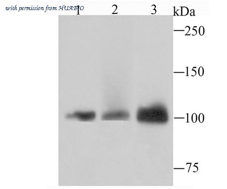 HUABIO ET1705-77 image 1