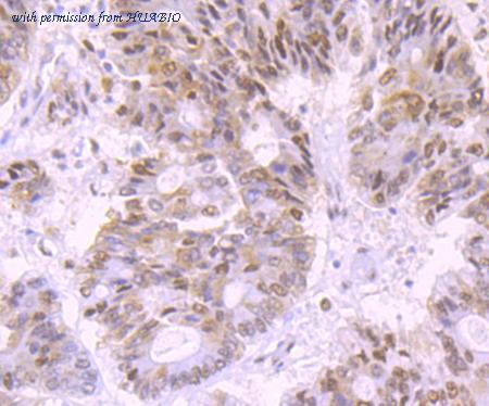 HUABIO ET1705-77 image 2