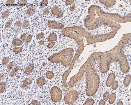 HUABIO ET1705-85 image 3