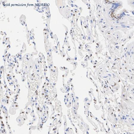 HUABIO ET1705-89 image 2