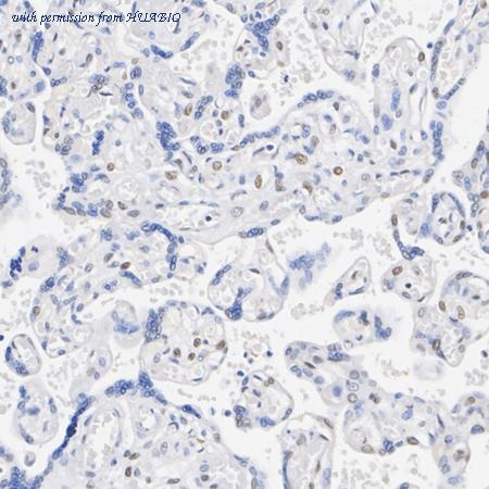 HUABIO ET1705-89 image 3