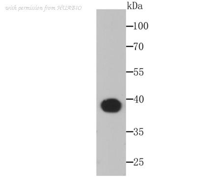HUABIO ET1705-91 image 2