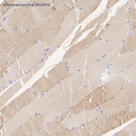 HUABIO ET1705-91 image 3