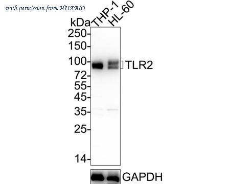 HUABIO ET1705-92-50UL image 1