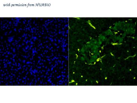 HUABIO ET1705-99 image 2