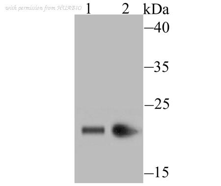HUABIO ET1706-02 image 1