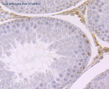 HUABIO ET1706-02 image 3