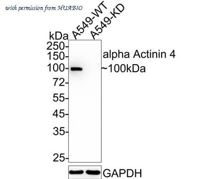 HUABIO ET1706-05 image 1