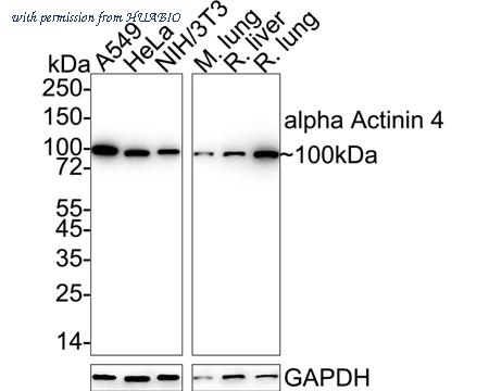HUABIO ET1706-05 image 2