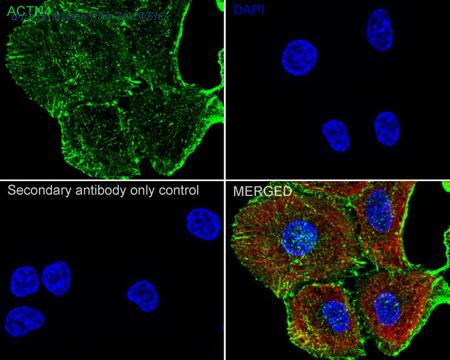 HUABIO ET1706-05 image 3