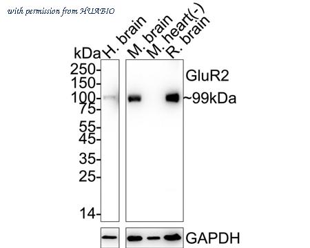 HUABIO ET1706-06 image 1