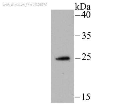 HUABIO ET1706-07 image 2
