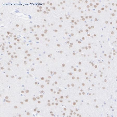 HUABIO ET1706-13 image 3