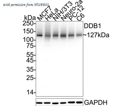 HUABIO ET1706-22 image 1