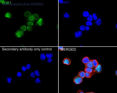 HUABIO ET1706-22 image 2