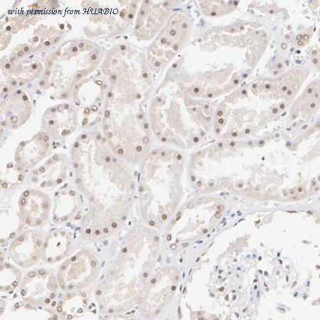 HUABIO ET1706-22 image 3