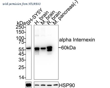 HUABIO ET1706-23 image 1