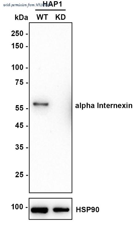 HUABIO ET1706-23 image 2