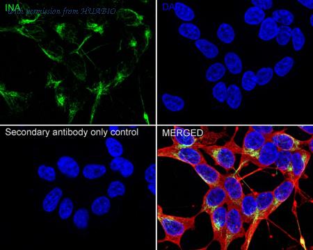 HUABIO ET1706-23 image 3