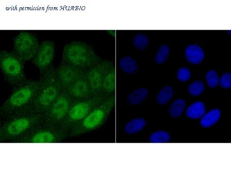 HUABIO ET1706-24 image 2