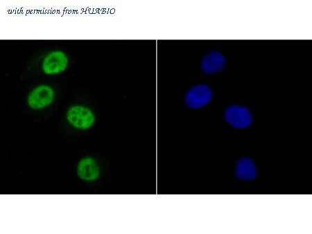 HUABIO ET1706-24 image 3