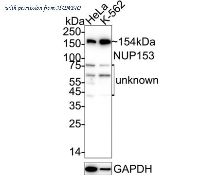 HUABIO ET1706-25 image 1