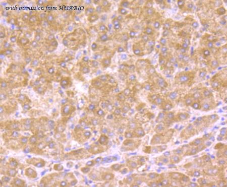 HUABIO ET1706-27 image 2