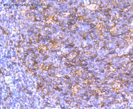 HUABIO ET1706-51 image 3