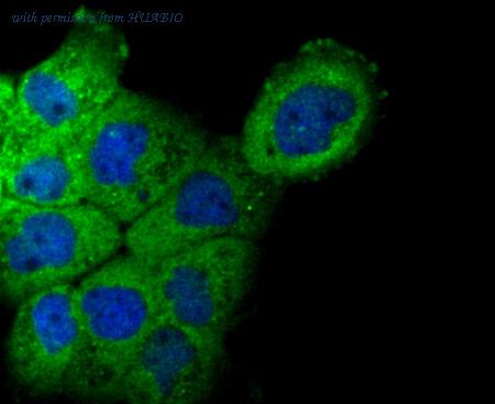 HUABIO ET7106-57 image 3