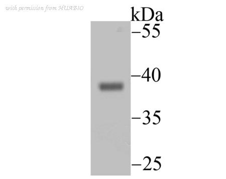 HUABIO ET7106-77 image 1