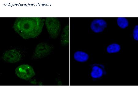 HUABIO ET7106-77 image 2