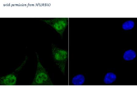 HUABIO ET7106-77 image 3