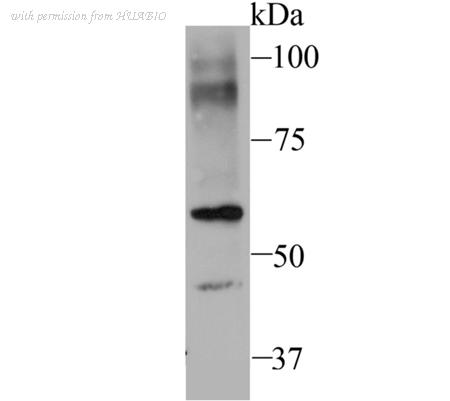 HUABIO ET7106-78 image 1